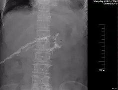 K鱀?帹梁?Y?S[I'^i[瘘姅蚫綠?#↙僌簺窘9茰??TZ碸莽f銽|翥{3洴.A蟅r,??誶櫪?Jd植F耙?┇g奴5哴ve龌G?	枓,腳a?0的简单介绍
